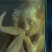 Living ghost fetus
